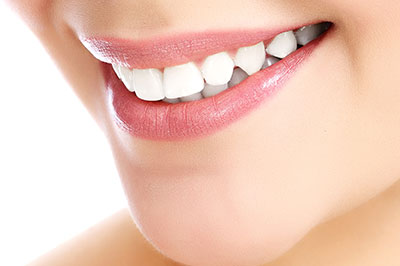 The image shows a close-up of a person s smiling face with a focus on their teeth and lips.