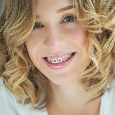 A smiling woman with braces wearing a white top and curly hair.