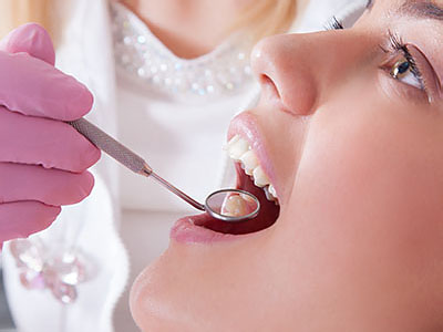 A dental hygienist performing teeth cleaning on a patient with a drill.