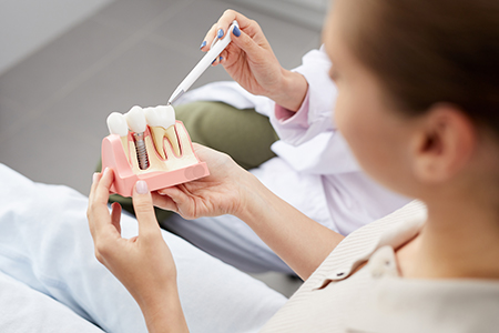 A dental professional in a white coat holding up a model mouth with teeth for demonstration purposes.