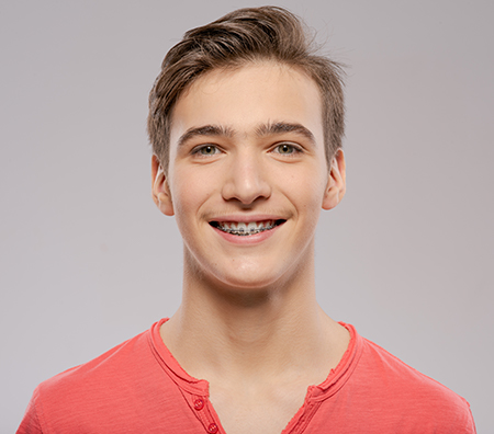 The image shows two side-by-side photographs of a young man with a bright smile against a plain background, displaying his face from different angles.